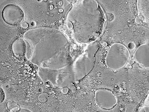 Measles Virus representative image