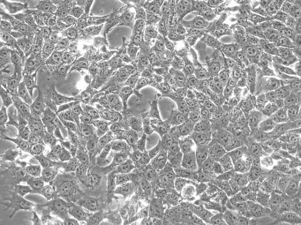 4T1 Cells