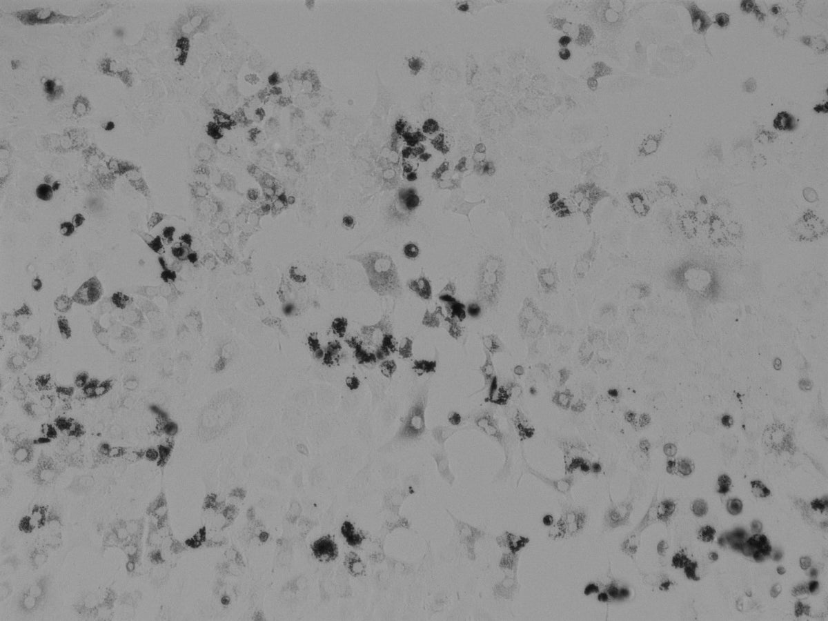 Tyrosinase