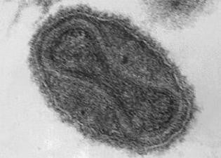 Vaccinia Virus representative image