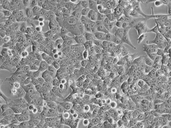 HCT116 Cells