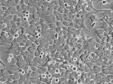 HCT116 Cells representative image