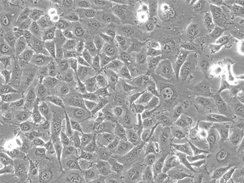 HT1080 Cells representative image