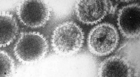 Herpes Simplex Virus representative image
