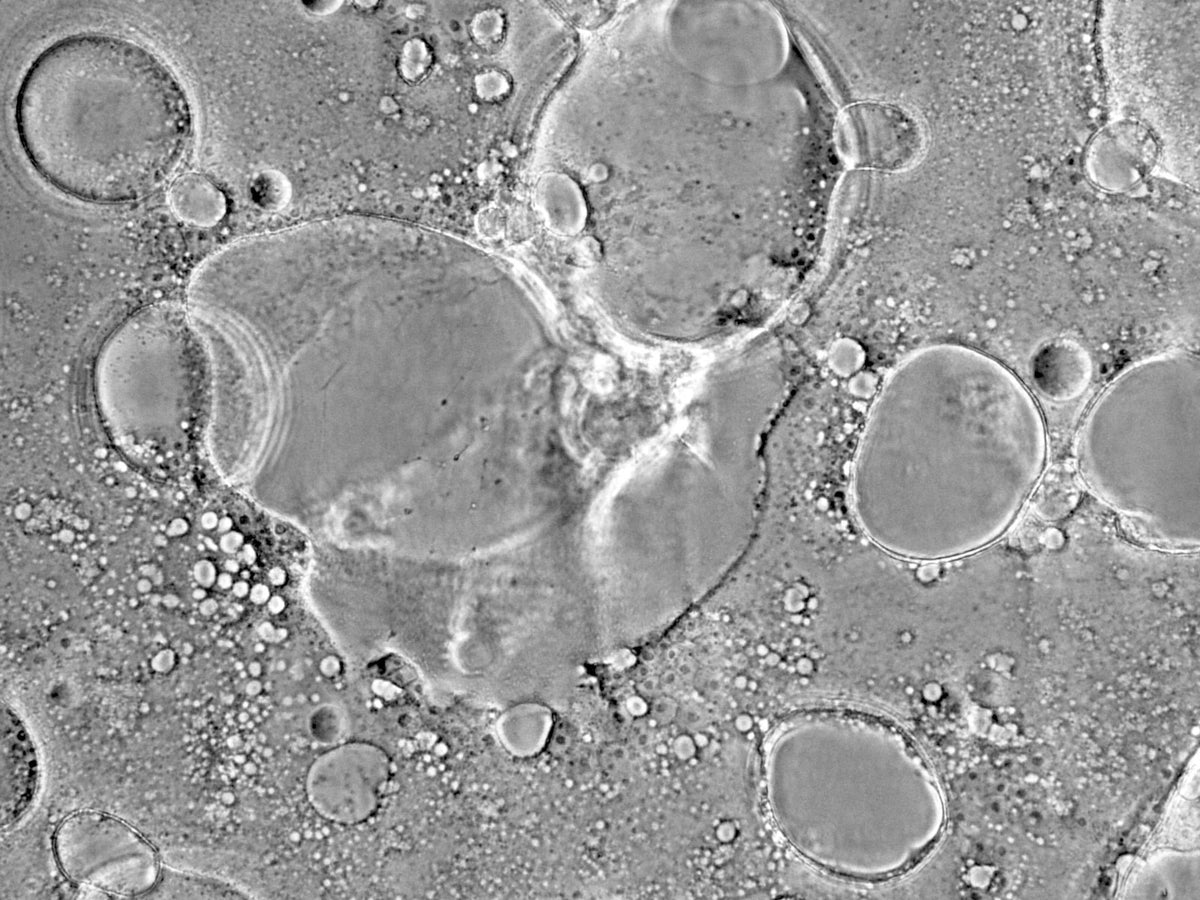 Measles Virus
