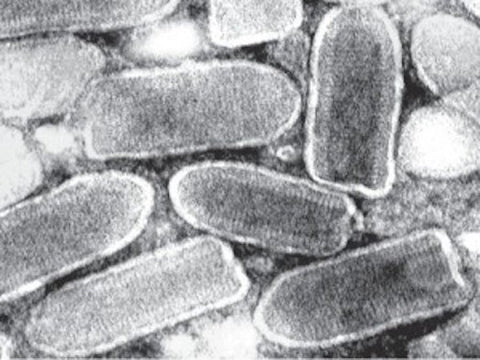 Vesicular Stomatitis Virus representative image