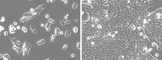4T1-mNIS(monoclonal)