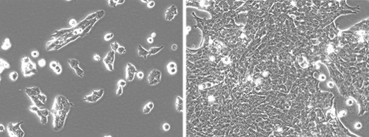 4T1-mNIS(monoclonal)