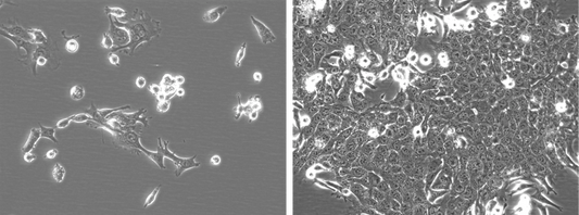 4T1-Fluc-Neo/iRFP-Puro